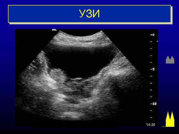 УЗИ 14 -26 