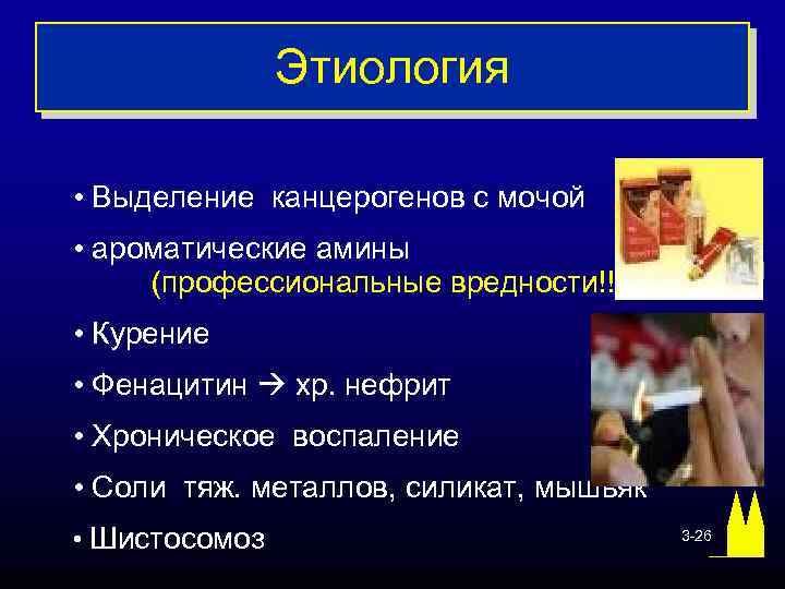 Этиология • Выделение канцерогенов с мочой • ароматические амины (профессиональные вредности!!!) • Курение •