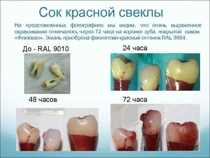 Сок красной свеклы На представленных фотографиях мы видим, что очень выраженное окрашивание отмечалось через