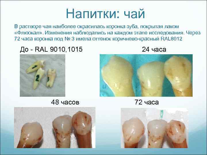 Напитки: чай В растворе чая наиболее окрасилась коронка зуба, покрытая лаком «Флюокал» . Изменения