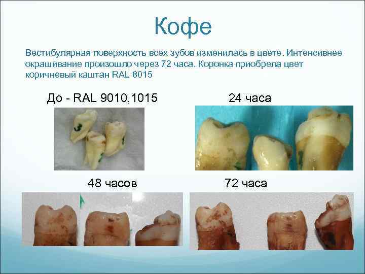 Кофе Вестибулярная поверхность всех зубов изменилась в цвете. Интенсивнее окрашивание произошло через 72 часа.
