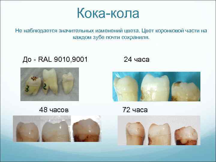 Кока-кола Не наблюдается значительных изменений цвета. Цвет коронковой части на каждом зубе почти сохраниля.