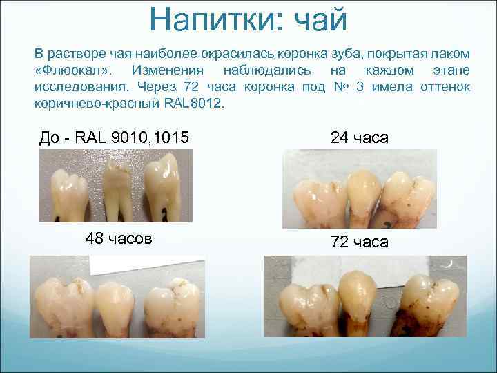 Напитки: чай В растворе чая наиболее окрасилась коронка зуба, покрытая лаком «Флюокал» . Изменения