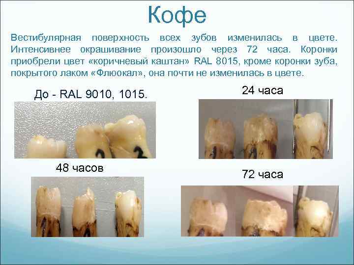 Кофе Вестибулярная поверхность всех зубов изменилась в цвете. Интенсивнее окрашивание произошло через 72 часа.