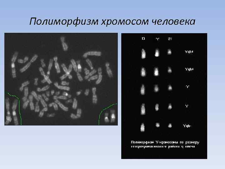 Полиморфизм хромосом человека 