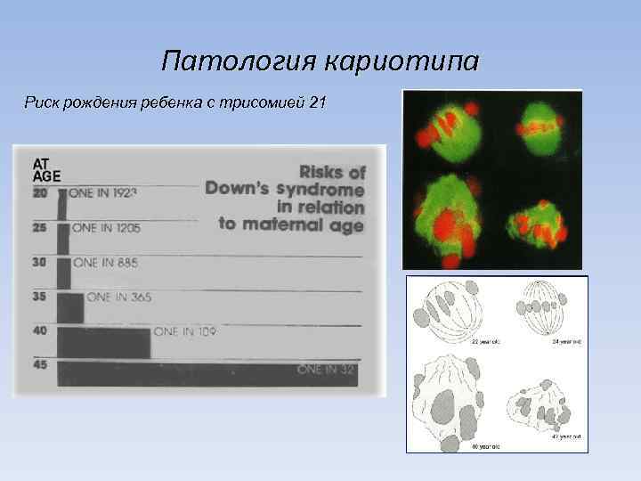 Патология кариотипа Риск рождения ребенка с трисомией 21 