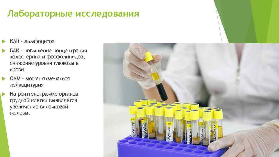 Лабораторные исследования КАК – лимфоцитоз БАК - повышение концентрации холестерина и фосфолипидов, снижение уровня