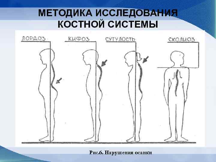 Тестовая карта для выявления нарушений осанки