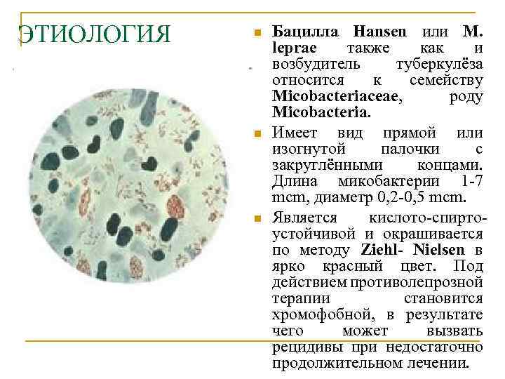 ЭТИОЛОГИЯ n n n Бацилла Hansen или M. leprae также как и возбудитель туберкулёза