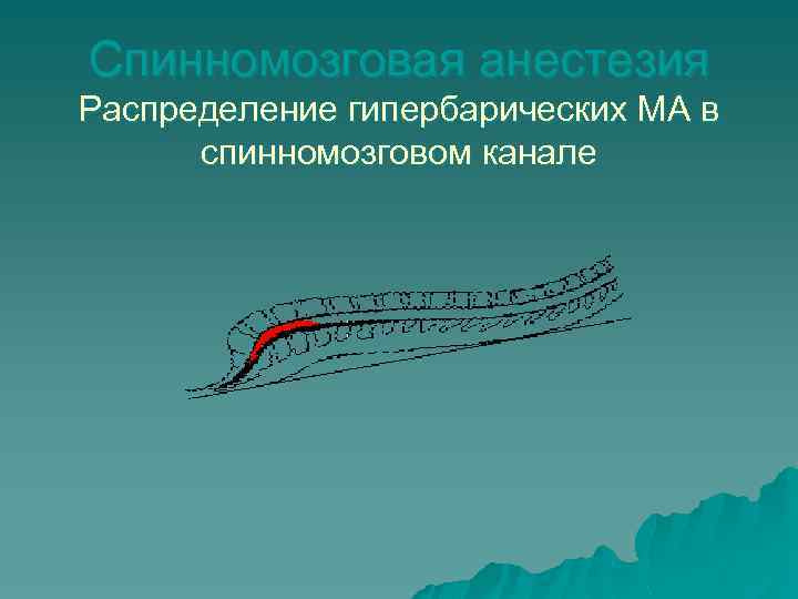 Спинномозговая анестезия Распределение гипербарических МА в спинномозговом канале 