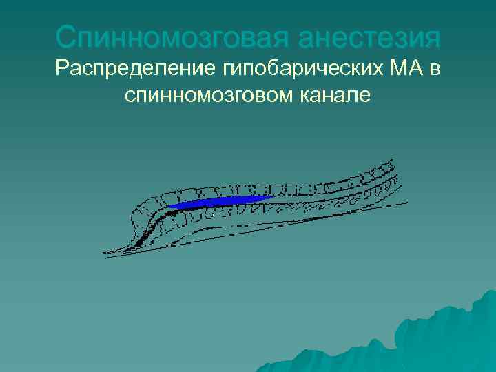 Спинномозговая анестезия Распределение гипобарических МА в спинномозговом канале 