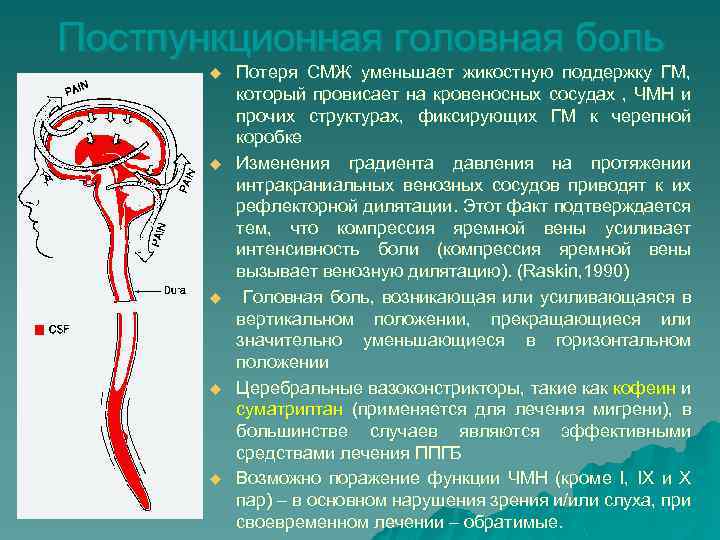 Постпункционная головная боль u u u Потеря СМЖ уменьшает жикостную поддержку ГМ, который провисает