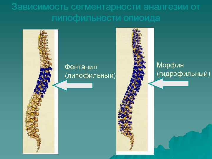 Зависимость сегментарности аналгезии от липофильности опиоида Фентанил (липофильный) Морфин (гидрофильный) 