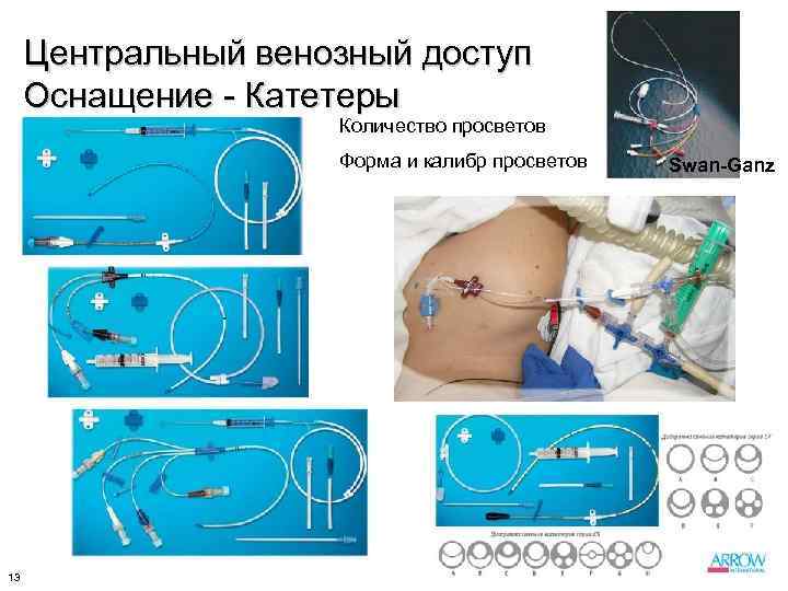 Центральный венозный доступ Оснащение - Катетеры Количество просветов Форма и калибр просветов 13 Swan-Ganz