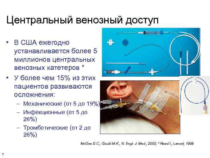 Центральный венозный доступ • В США ежегодно устанавливается более 5 миллионов центральных венозных катетеров