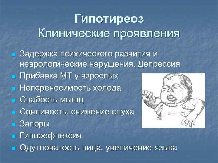 Гипотиреоз Клинические проявления n n n n Задержка психического развития и неврологические нарушения. Депрессия