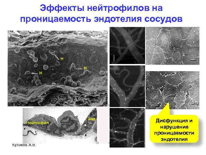 Эффекты нейтрофилов на проницаемость эндотелия сосудов Дисфункция и нарушение проницаемости эндотелия Куликов А. В.