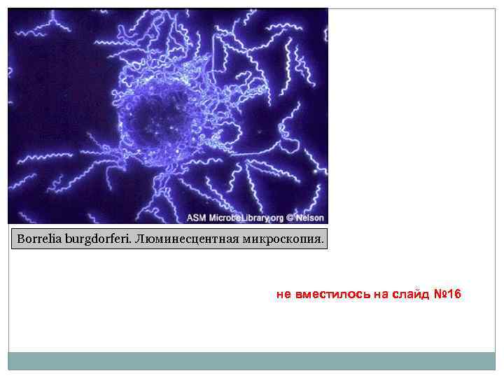 Borrelia burgdorferi. Люминесцентная микроскопия. не вместилось на слайд № 16 