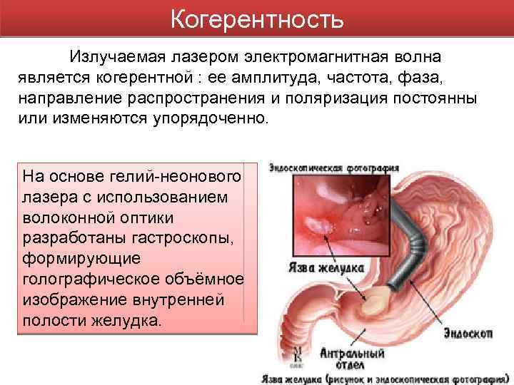 Когерентность Излучаемая лазером электромагнитная волна является когерентной : ее амплитуда, частота, фаза, направление распространения