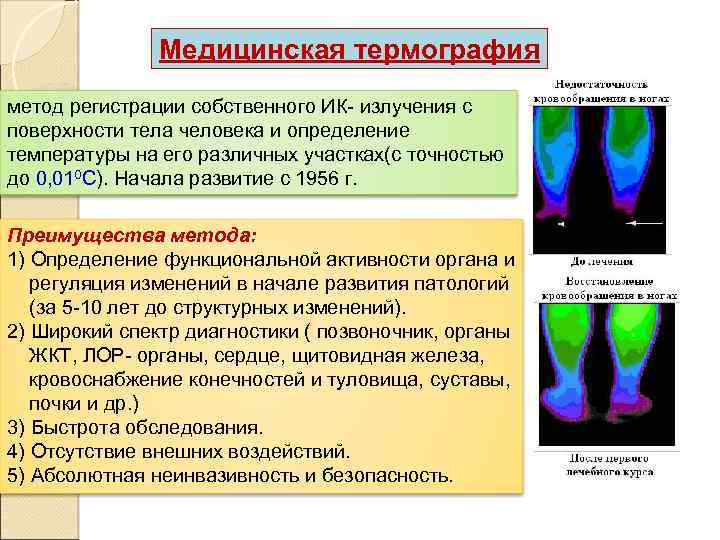 Медицинская термография презентация