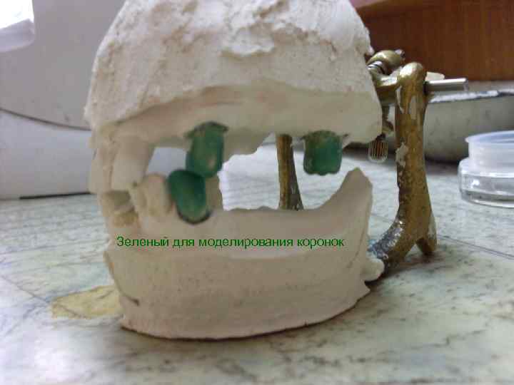 Зеленый для моделирования коронок 