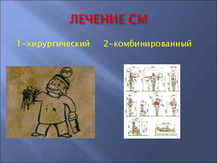 1 -хирургический 2 -комбинированный 