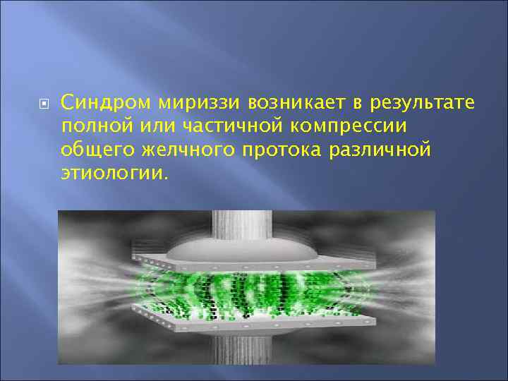  Синдром мириззи возникает в результате полной или частичной компрессии общего желчного протока различной