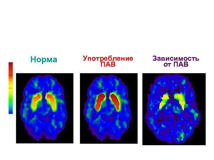 Норма Употребление ПАВ Зависимость от ПАВ 