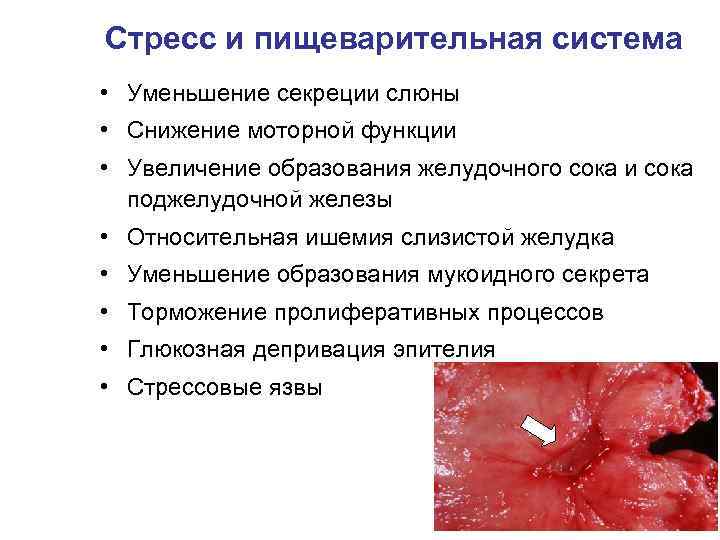 Стресс и пищеварительная система • Уменьшение секреции слюны • Снижение моторной функции • Увеличение