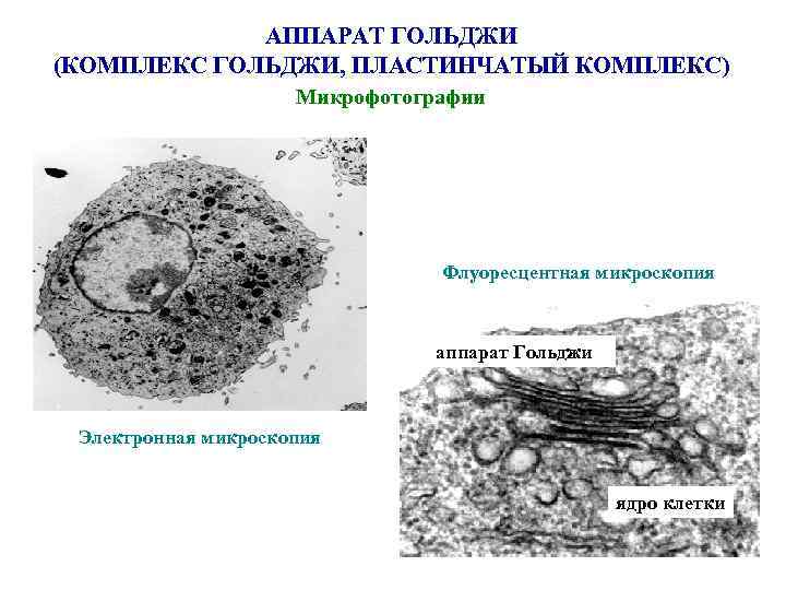 АППАРАТ ГОЛЬДЖИ (КОМПЛЕКС ГОЛЬДЖИ, ПЛАСТИНЧАТЫЙ КОМПЛЕКС) Микрофотографии Флуоресцентная микроскопия аппарат Гольджи Электронная микроскопия ядро