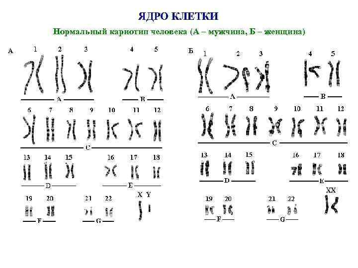 ЯДРО КЛЕТКИ Нормальный кариотип человека (А – мужчина, Б – женщина) 