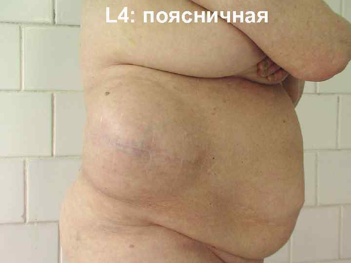 L 4: поясничная 