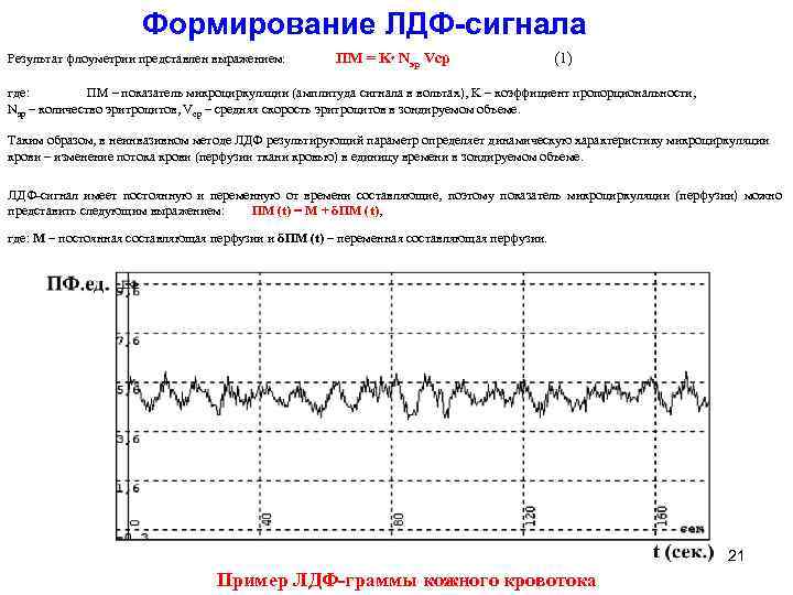 Формирование ЛДФ-сигнала Результат флоуметрии представлен выражением: ПМ = K Nэр Vср (1) где: ПМ