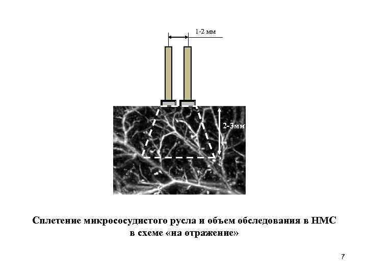 1 -2 мм 2 -3 мм Сплетение микрососудистого русла и объем обследования в НМС
