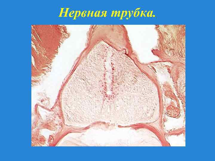 Нервная трубка. 