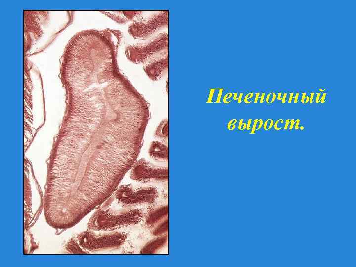 Печеночный вырост. 