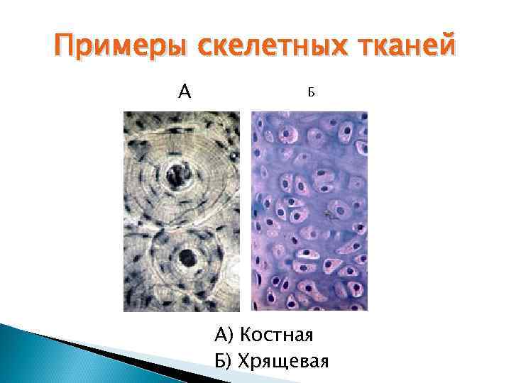 Примеры скелетных тканей А Б А) Костная Б) Хрящевая 