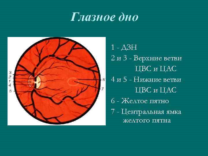 Глазное дно 1 - ДЗН 2 и 3 - Верхние ветви ЦВС и ЦАС