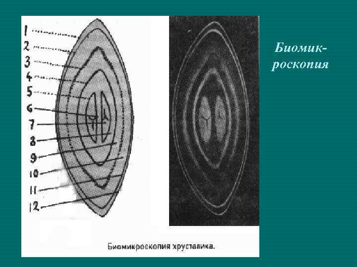 Биомикроскопия 