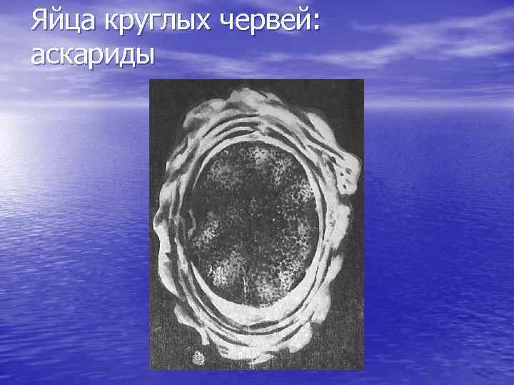 Яйца круглых червей: аскариды 