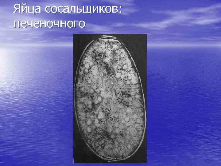 Яйца сосальщиков: печеночного 