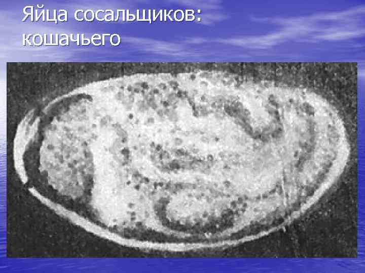 Яйца сосальщиков: кошачьего 