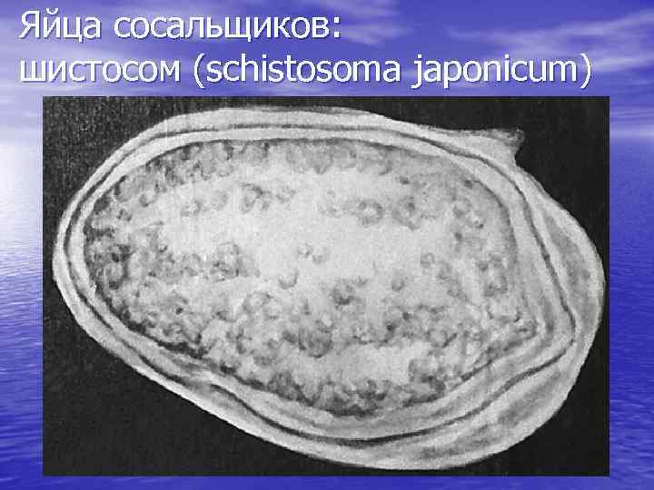 Яйца сосальщиков: шистосом (schistosoma japonicum) 
