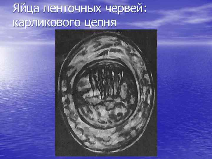 Яйца ленточных червей: карликового цепня 