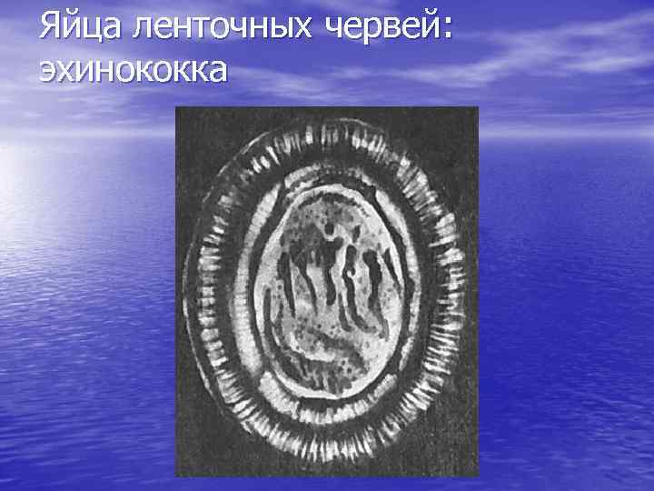 Яйца ленточных червей: эхинококка 