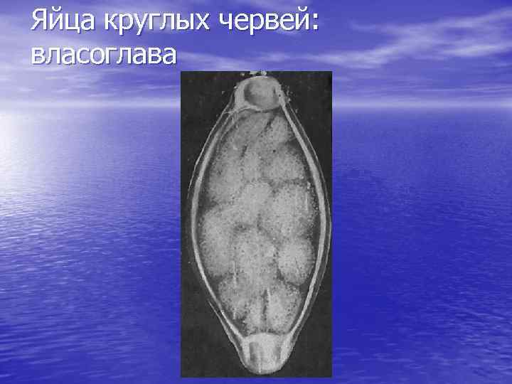 Яйца круглых червей: власоглава 