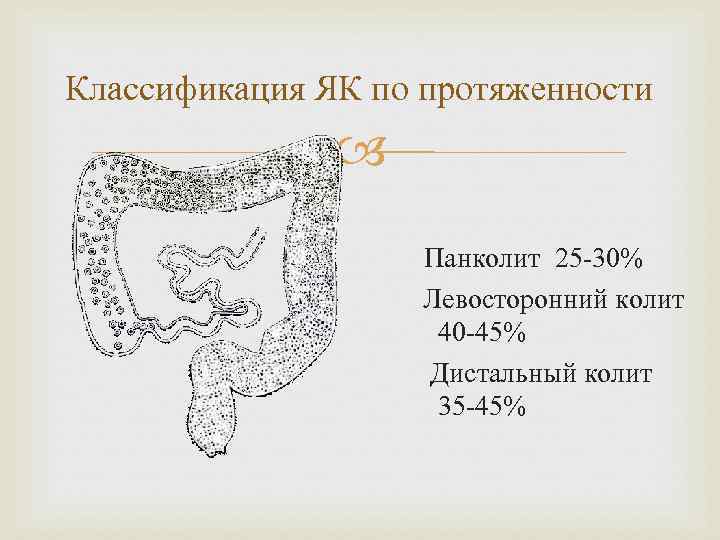 Классификация ЯК по протяженности Панколит 25 -30% Левосторонний колит 40 -45% Дистальный колит 35