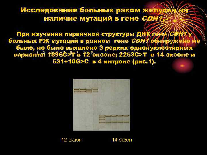 Исследование больных раком желудка на наличие мутаций в гене CDH 1. При изучении первичной