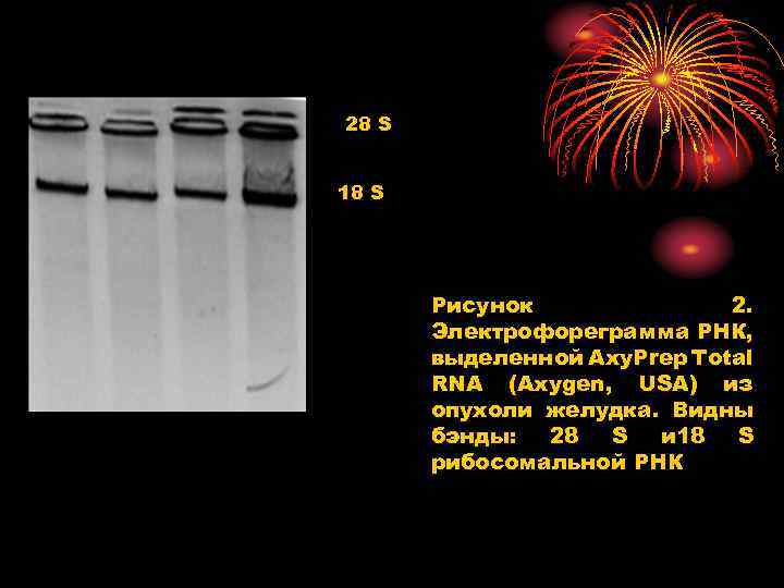 28 S 18 S Рисунок 2. Электрофореграмма РНК, выделенной Axy. Prep Total RNA (Axygen,