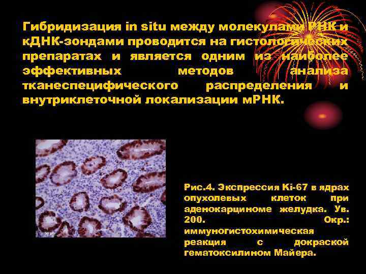 Гибридизация in situ между молекулами РНК и к. ДНК зондами проводится на гистологических препаратах